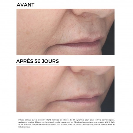 dermeden-retinal-concentre-retinoides-nuit-6-30ml-4.jpg
