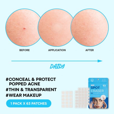 nolahour-spot-eraser-blue-step-patches-b63-4.jpg