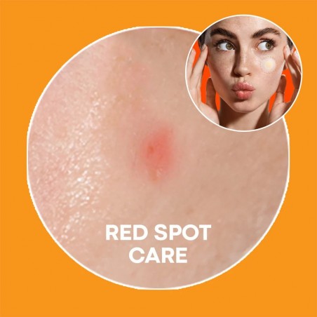 nolahour-spot-eraser-orange-patches-b12-2.jpg